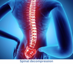 Spinal decompression